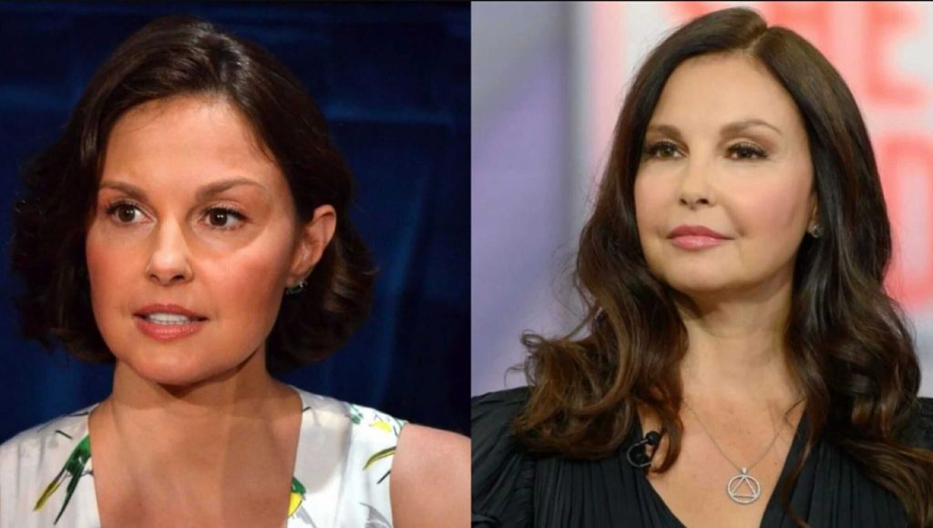 Ashley Judd Plastic Surgery